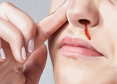 ���Ԥ���ǳ�Ѫ���Ͼ����Ǻ���ҽ�����